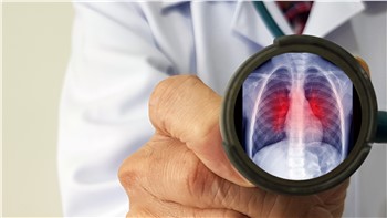 Mevsimsel Grip, Covid 19, Solunum Sinsityal Virüsü, Adenovirüs Combo Testi